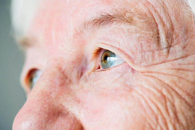 Cataracts Eye 